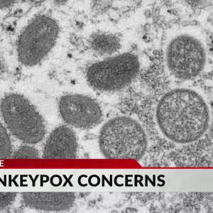 Expert: Monkeypox likely spread by sex at 2 raves in Europe