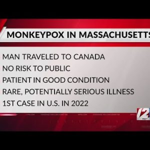First case of monkeypox in Massachusetts