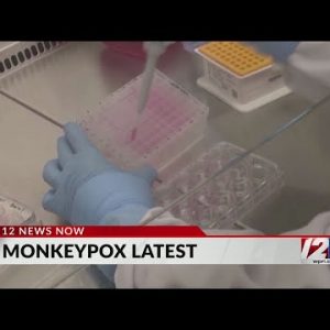 Mass. health officials confirm two additional cases of monkeypox