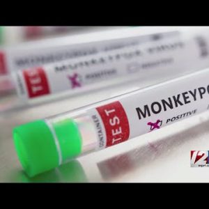 Massachusetts reports 4th monkeypox case