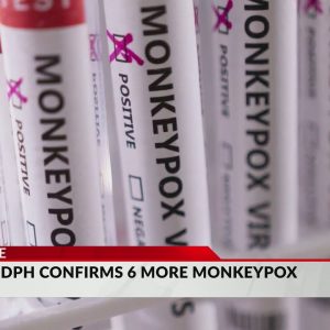 Massachusetts reports 6 more monkeypox cases